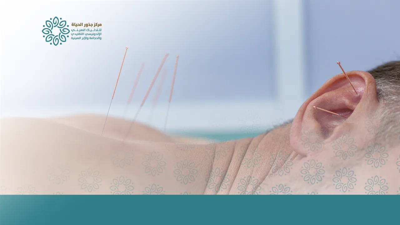 أنواع الإبر الصينية