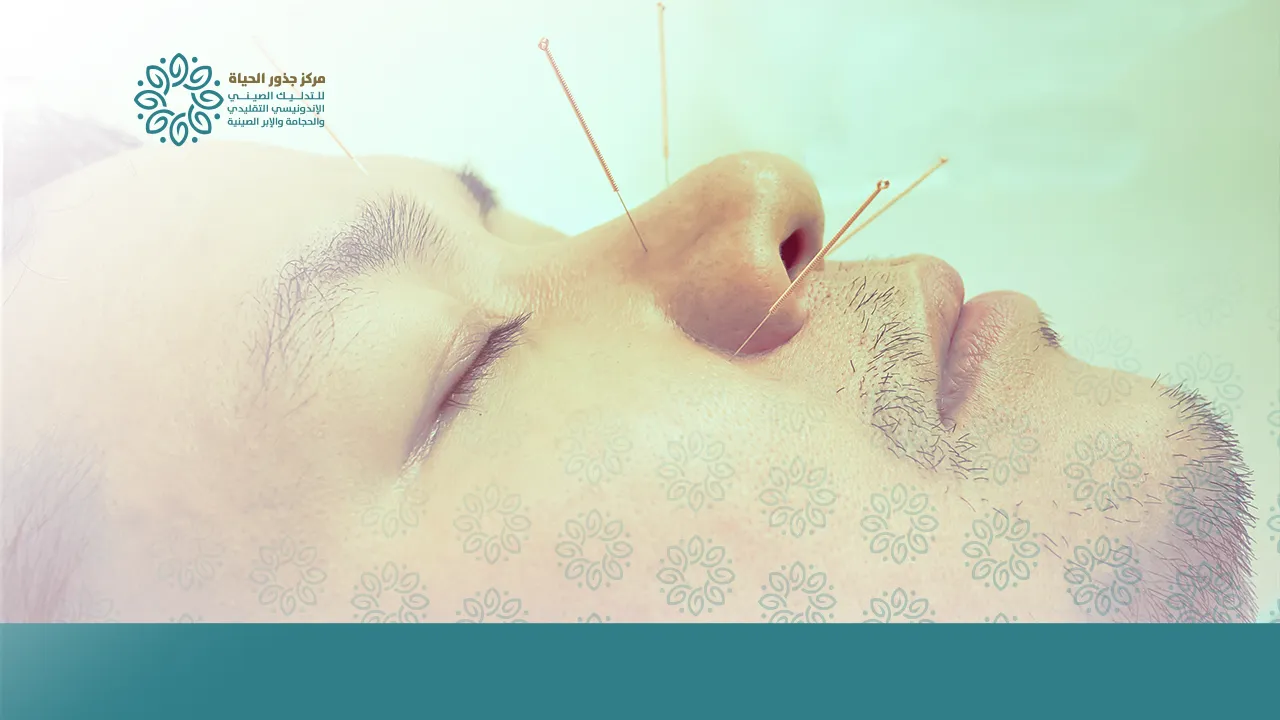أضرار الإبر الصينية للتخسيس