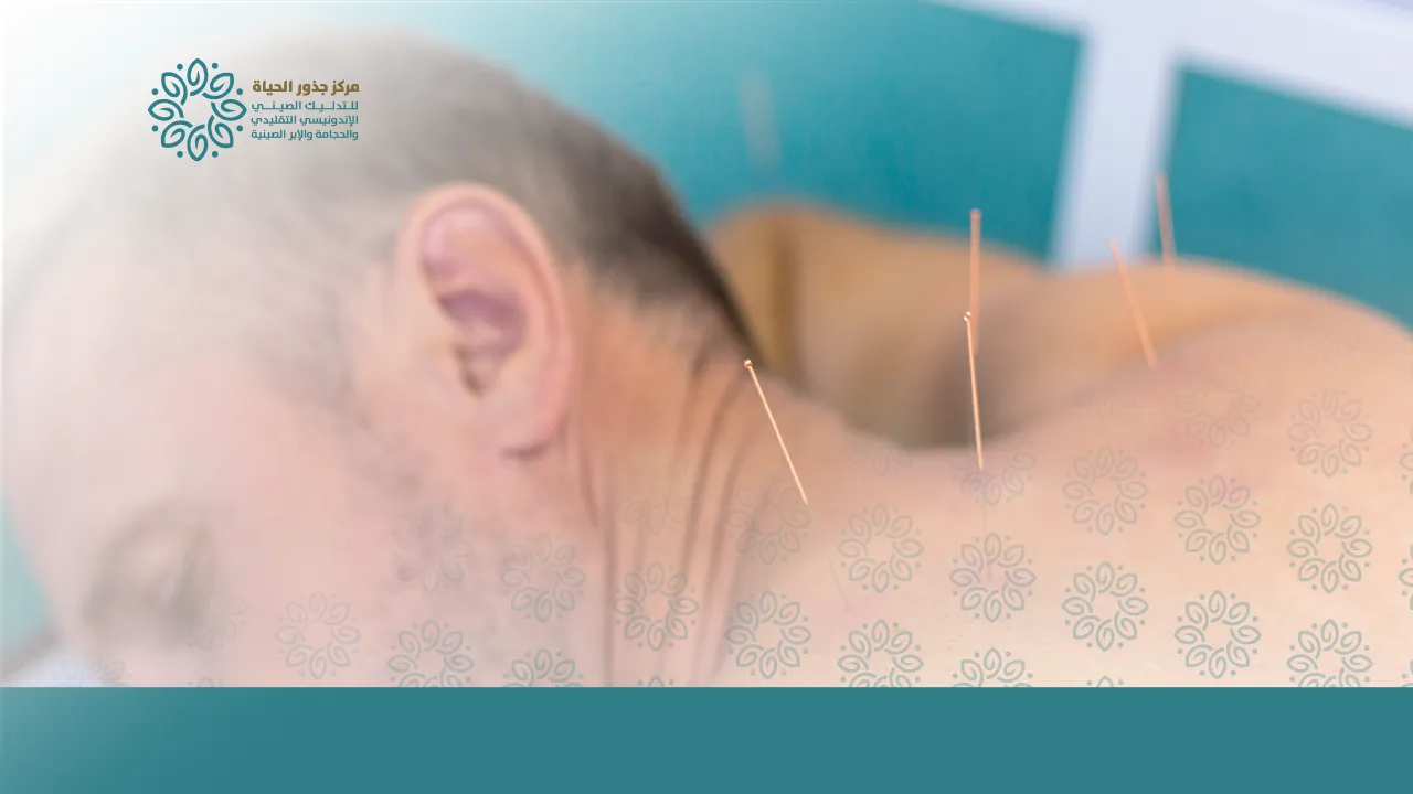 أنواع الإبر الصينية