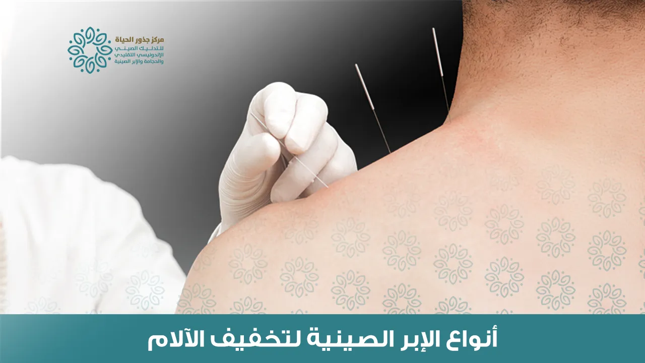 Types of Chinese acupuncture