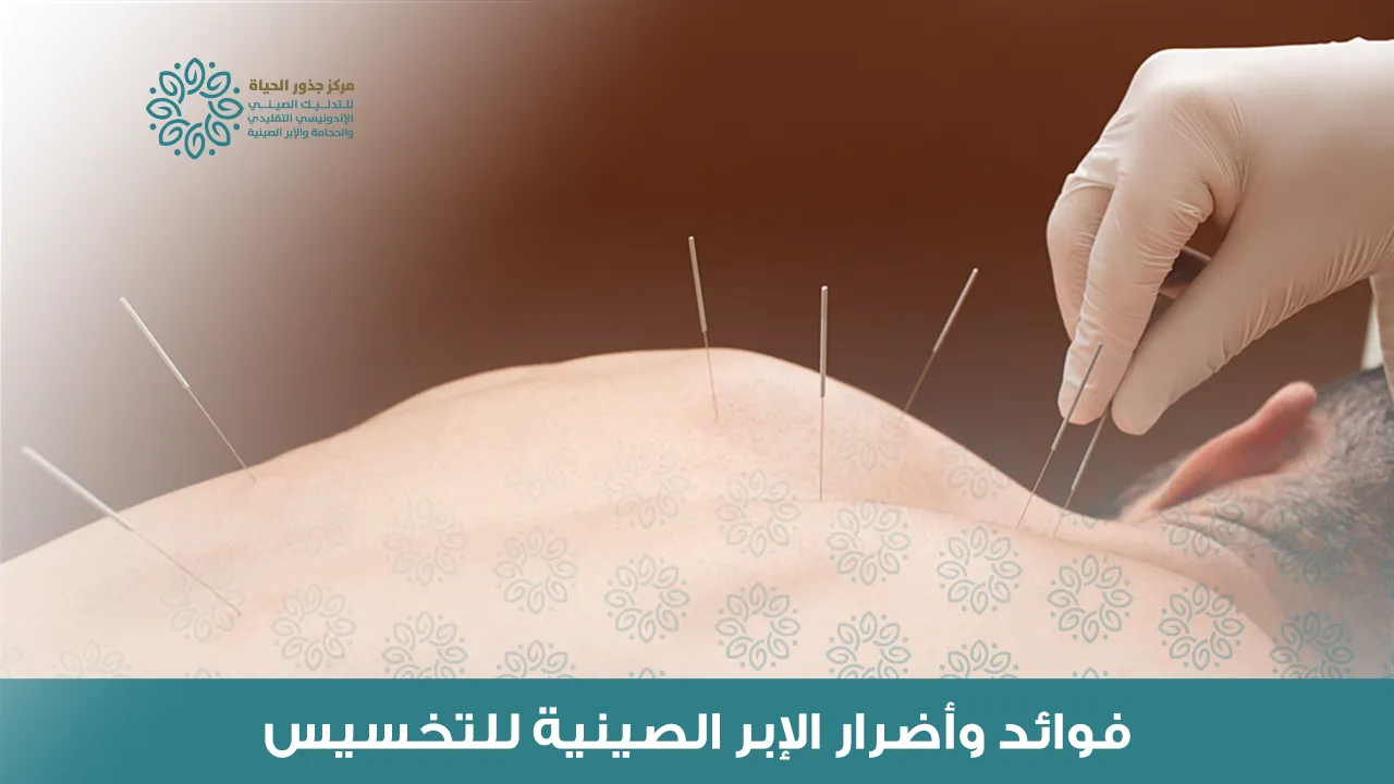 أضرار الإبر الصينية للتخسيس