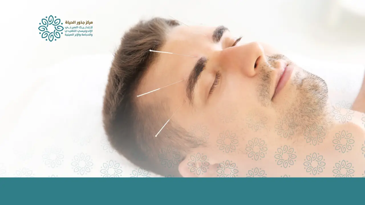 الإبر الصينية للوجه