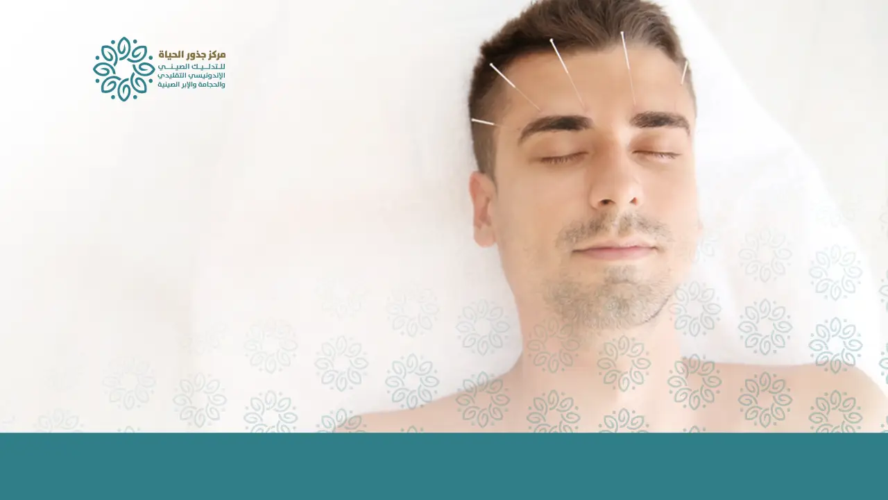 الإبر الصينية للوجه