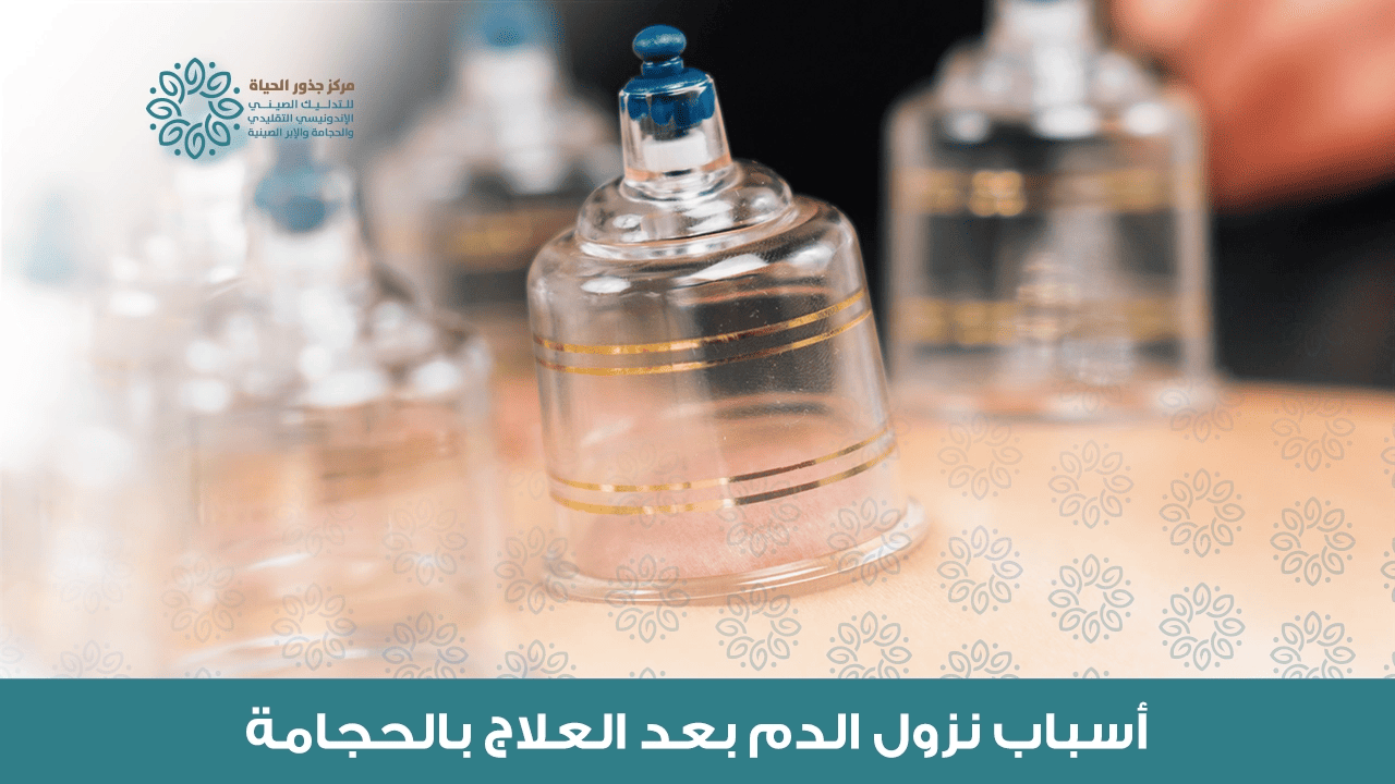 أسباب نزول الدم بعد الحجامة